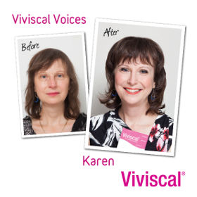 viviscal before and after