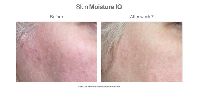 Advanced Nutrition Programme Case Study Results Skin Moisture IQ