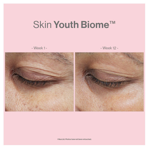 Advanced Nutrition Programme Case Study Results Skin Youth Biome 