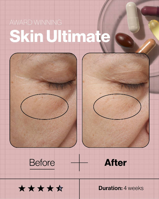 Skin Ultimate Before And After untouched