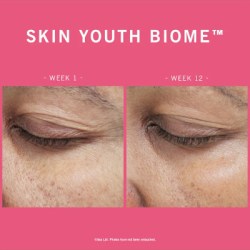 Skin Youth Biome 10 Day Recovery Pack